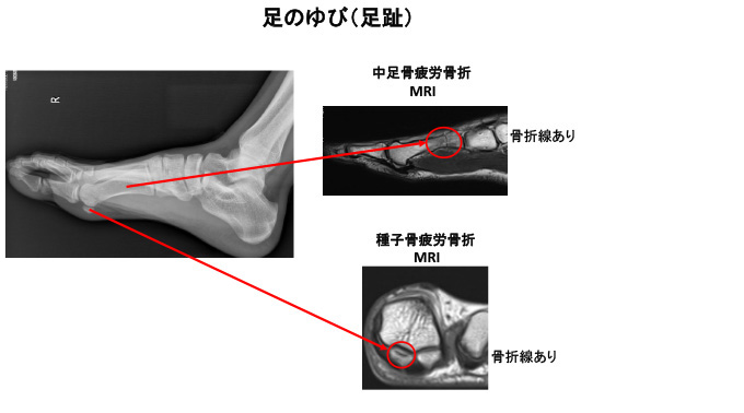 hirou051